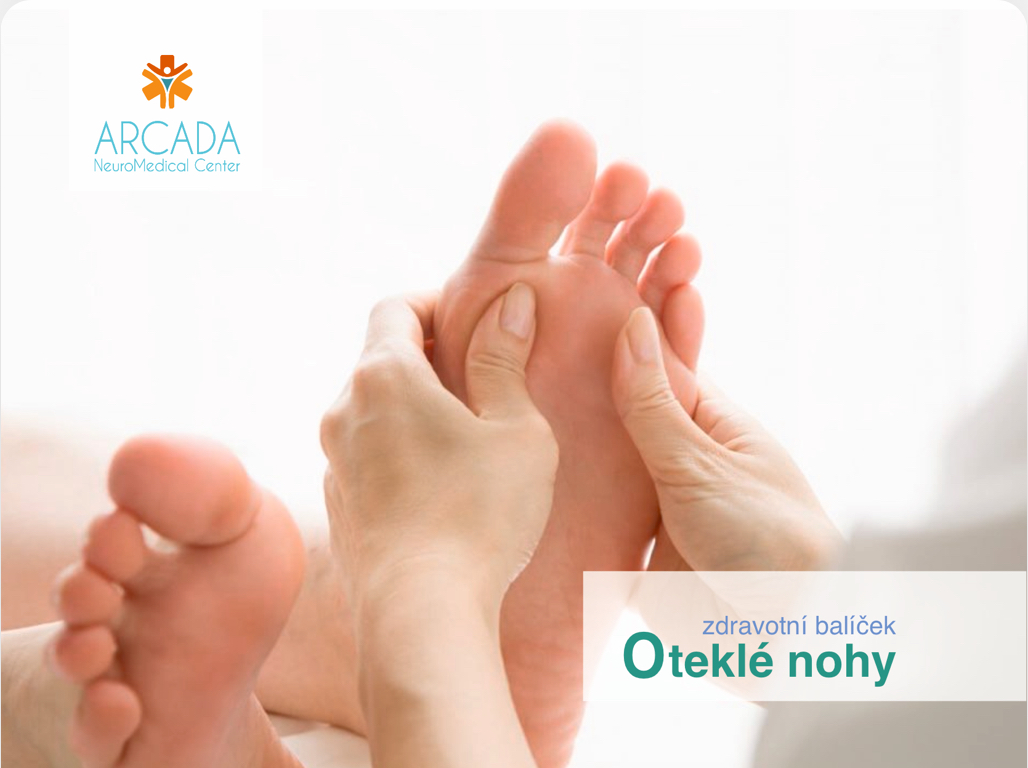 OTEKLÉ NOHY