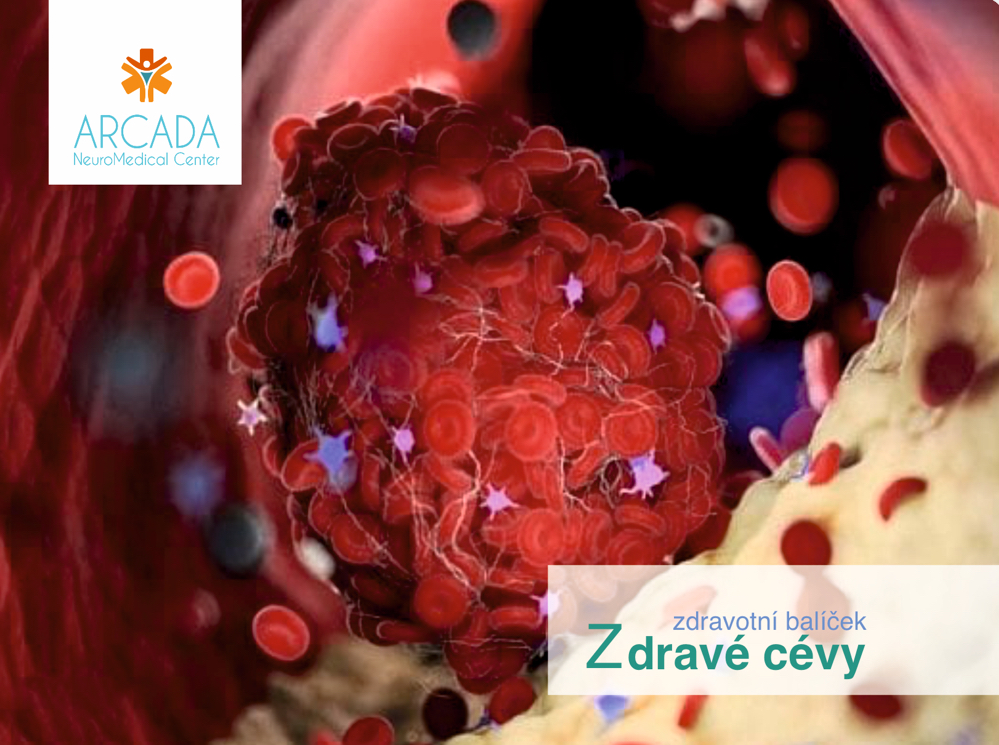 ZDRAVÉ CÉVY
